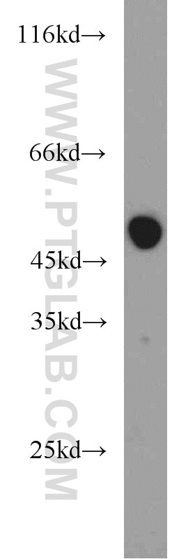 Western Blot (WB) analysis of mouse skin tissue using KRT36 Polyclonal antibody (14309-1-AP)