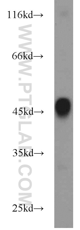 Western Blot (WB) analysis of mouse skin tissue using KRT36 Polyclonal antibody (14309-1-AP)