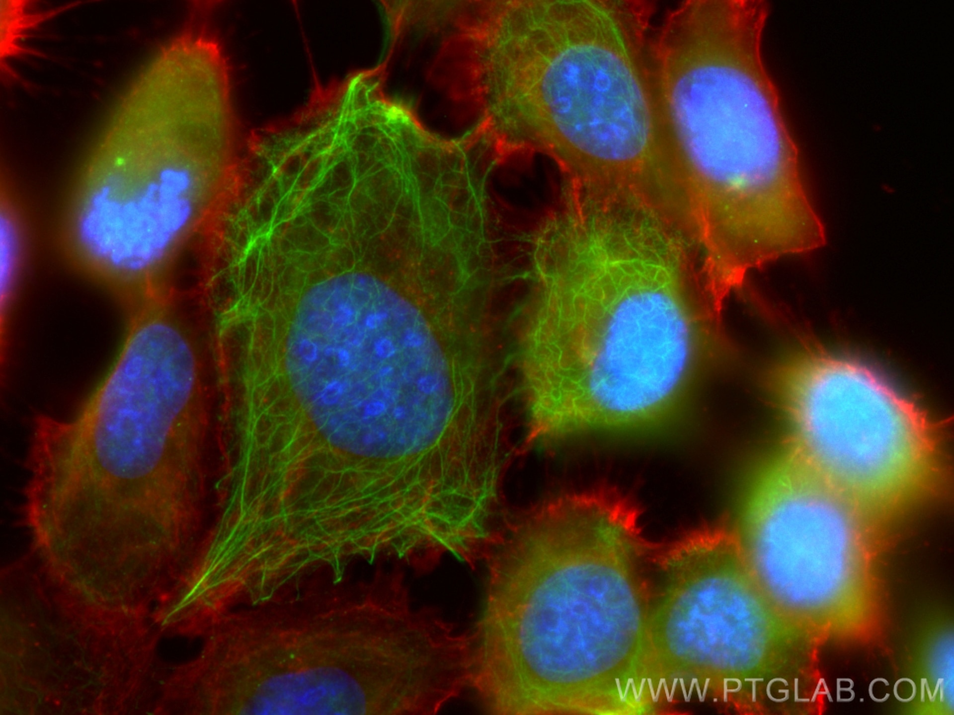 Immunofluorescence (IF) / fluorescent staining of A431 cells using Cytokeratin 4 Polyclonal antibody (16572-1-AP)