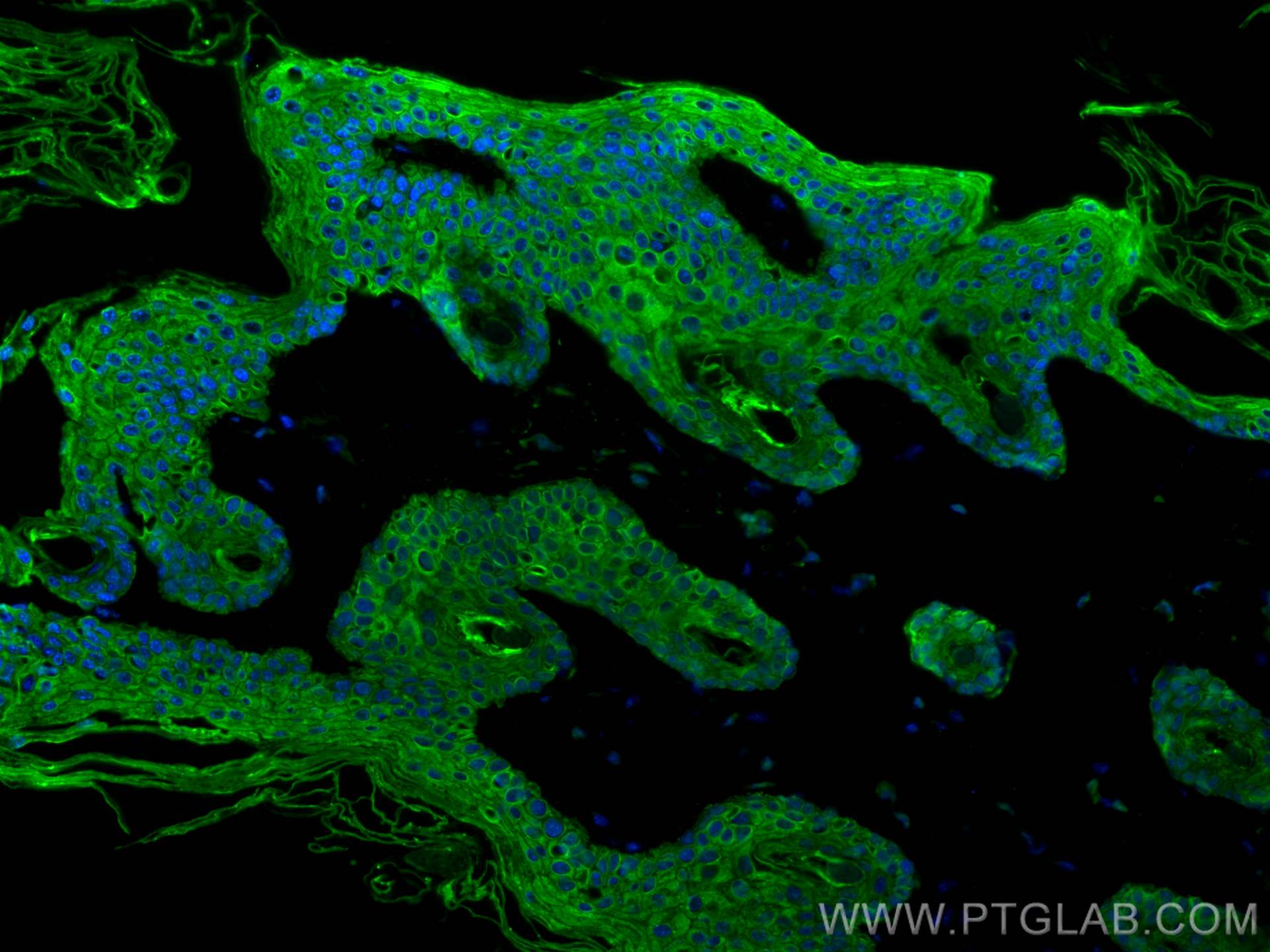 Immunofluorescence (IF) / fluorescent staining of mouse skin tissue using Cytokeratin 4 Polyclonal antibody (16572-1-AP)