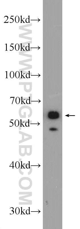 Western Blot (WB) analysis of A431 cells using Cytokeratin 4 Polyclonal antibody (16572-1-AP)