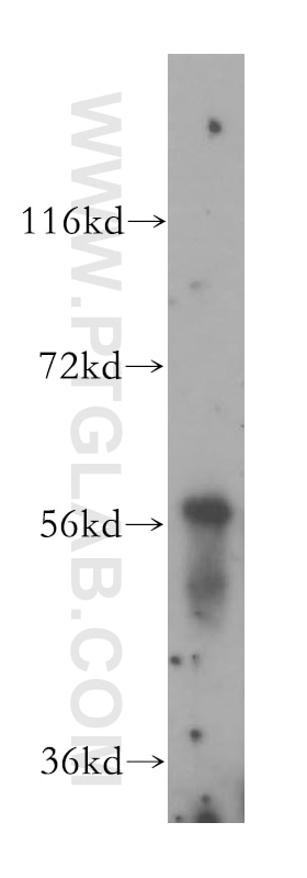 Western Blot (WB) analysis of human bladder tissue using Cytokeratin 4 Polyclonal antibody (16572-1-AP)