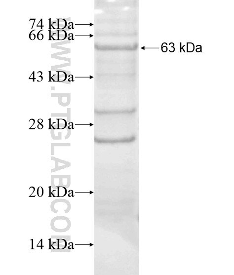 KRT4 fusion protein Ag20210 SDS-PAGE