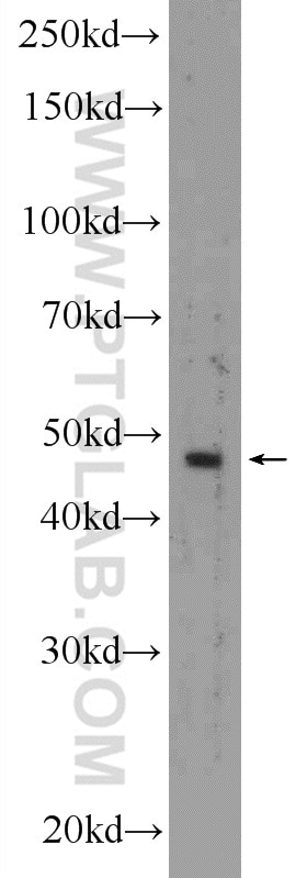Western Blot (WB) analysis of A431 cells using KRT40 Polyclonal antibody (25398-1-AP)