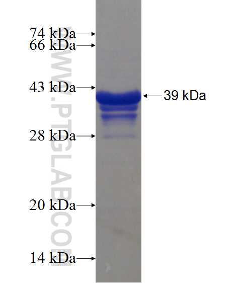 KRT40 fusion protein Ag21889 SDS-PAGE