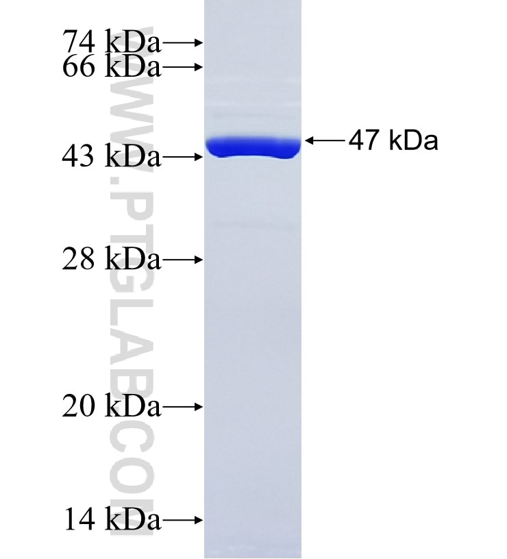 KRT5 fusion protein Ag24184 SDS-PAGE