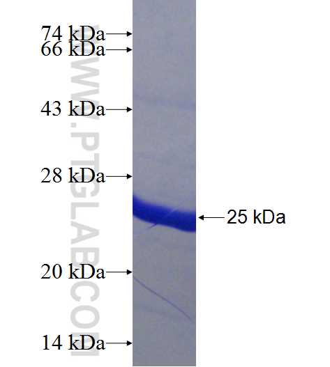 KRT5 fusion protein Ag24194 SDS-PAGE
