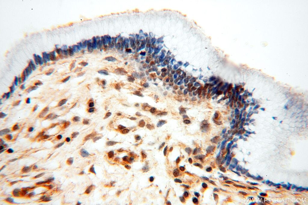 Cytokeratin 6A-specific