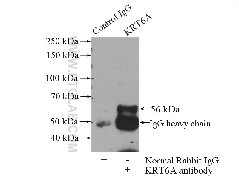Immunoprecipitation (IP) experiment of HeLa cells using Cytokeratin 6A-specific Polyclonal antibody (16853-1-AP)