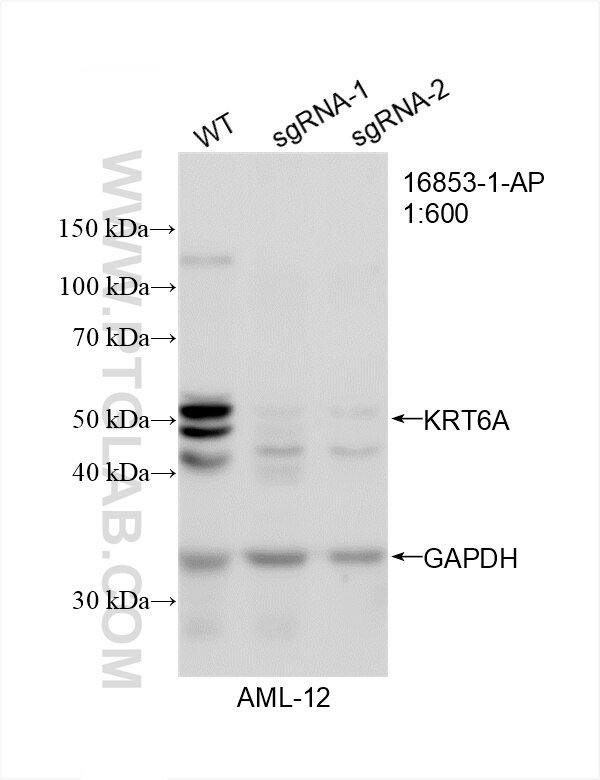 Western Blot (WB) analysis of AML12 cells using Cytokeratin 6A-specific Polyclonal antibody (16853-1-AP)