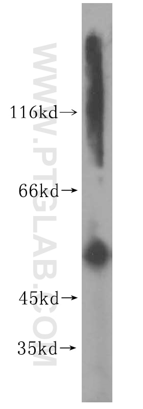 Western Blot (WB) analysis of A431 cells using Cytokeratin 6A-specific Polyclonal antibody (16853-1-AP)