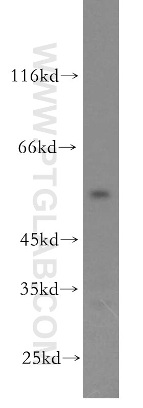 Western Blot (WB) analysis of HeLa cells using Cytokeratin 6A-specific Polyclonal antibody (16853-1-AP)