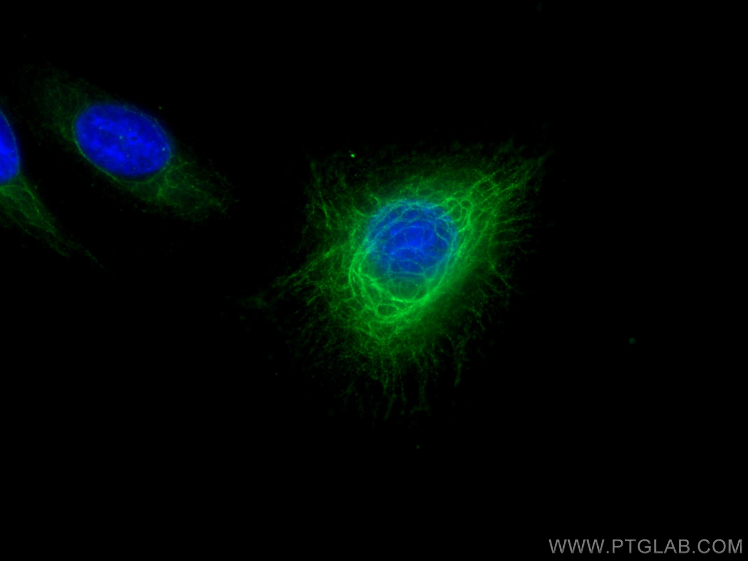 Immunofluorescence (IF) / fluorescent staining of A431 cells using Cytokeratin 6A Polyclonal antibody (10590-1-AP)