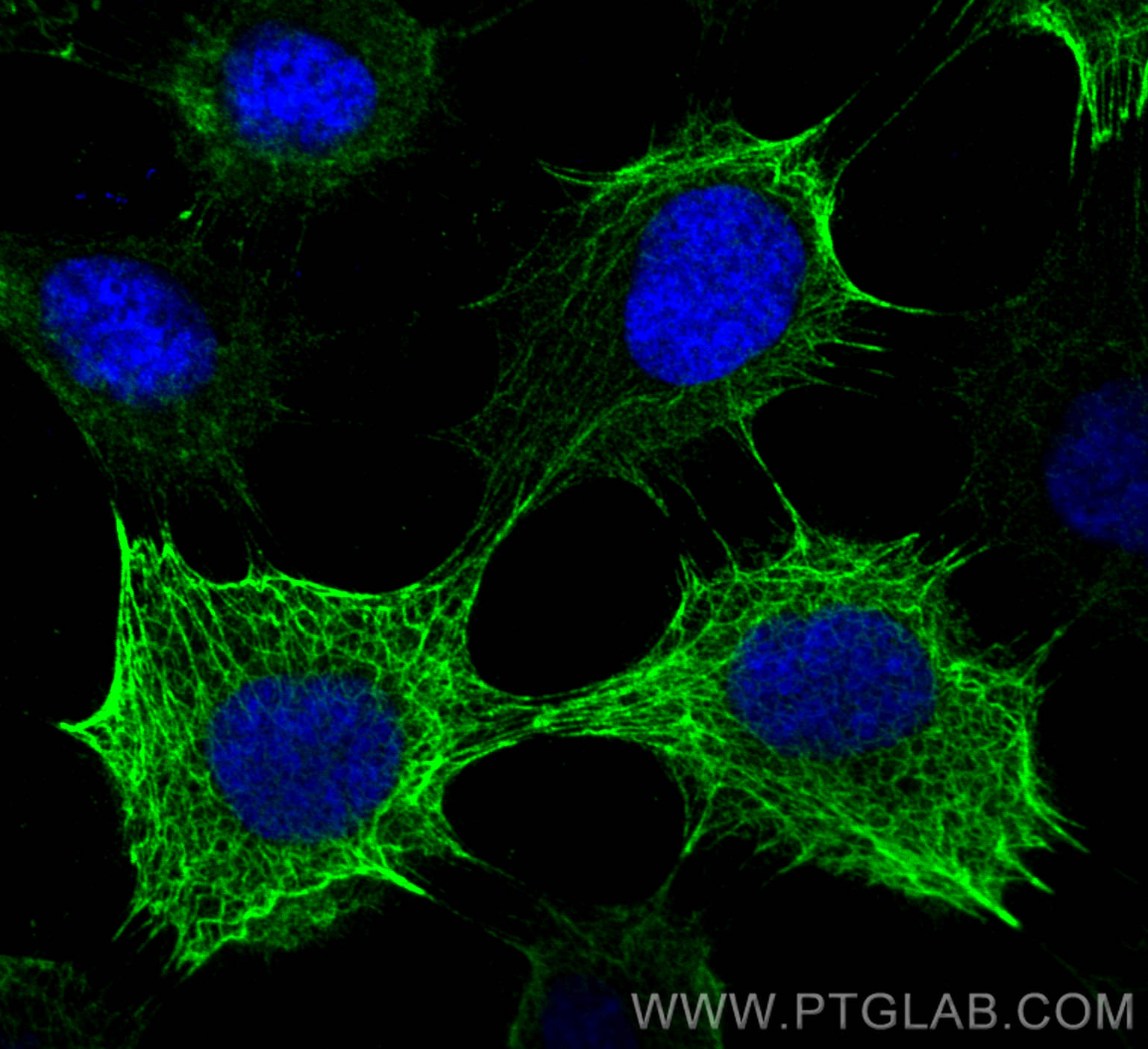 Immunofluorescence (IF) / fluorescent staining of A431 cells using Cytokeratin 6A Polyclonal antibody (10590-1-AP)