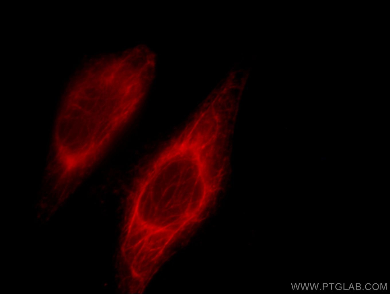 Immunofluorescence (IF) / fluorescent staining of HeLa cells using Cytokeratin 6A Polyclonal antibody (10590-1-AP)