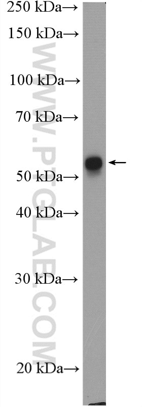 Western Blot (WB) analysis of A431 cells using Cytokeratin 6A Polyclonal antibody (10590-1-AP)
