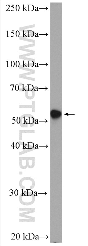 Western Blot (WB) analysis of U-251 cells using Cytokeratin 6A Polyclonal antibody (10590-1-AP)
