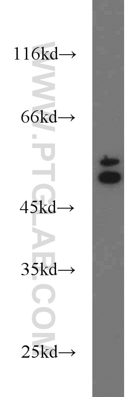 Western Blot (WB) analysis of MCF-7 cells using Cytokeratin 6A Polyclonal antibody (10590-1-AP)