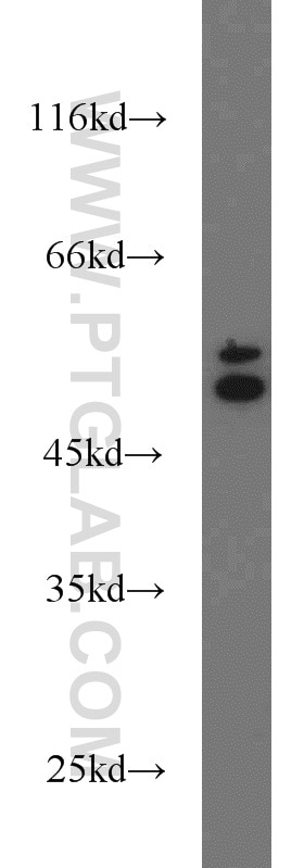 WB analysis of MCF-7 using 10590-1-AP