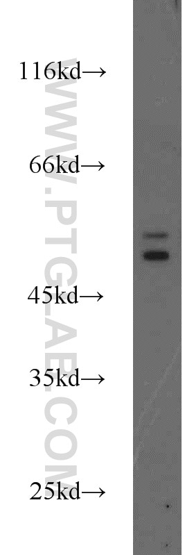 Western Blot (WB) analysis of HeLa cells using Cytokeratin 6A Polyclonal antibody (10590-1-AP)