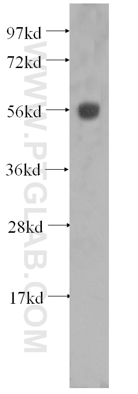 Western Blot (WB) analysis of MCF-7 cells using Cytokeratin 6A Polyclonal antibody (10590-1-AP)