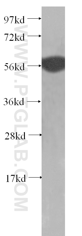 Western Blot (WB) analysis of A375 cells using Cytokeratin 6A Polyclonal antibody (10590-1-AP)
