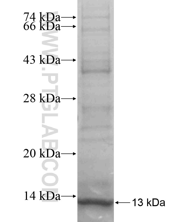 KRT6A fusion protein Ag17638 SDS-PAGE