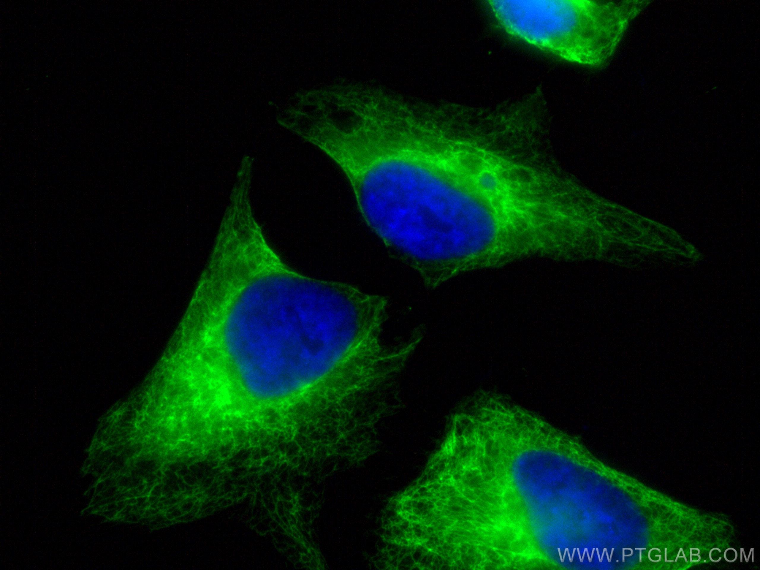 Immunofluorescence (IF) / fluorescent staining of HeLa cells using Cytokeratin 6B Polyclonal antibody (17391-1-AP)