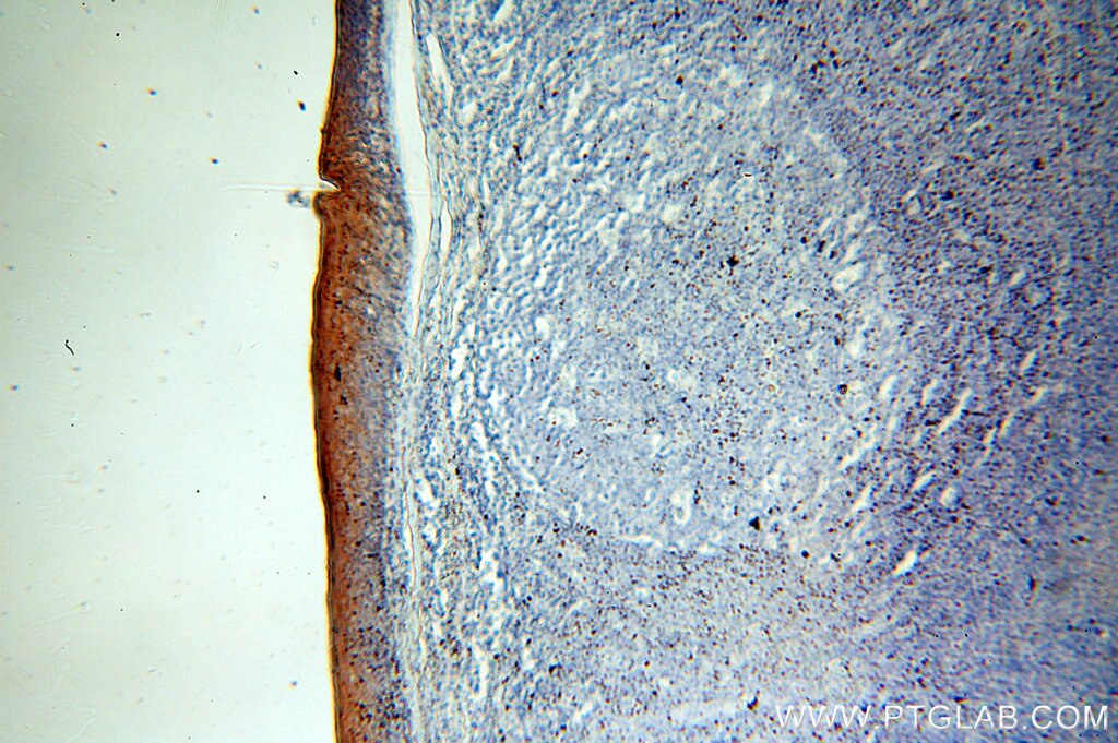 IHC staining of human tonsil using 17391-1-AP