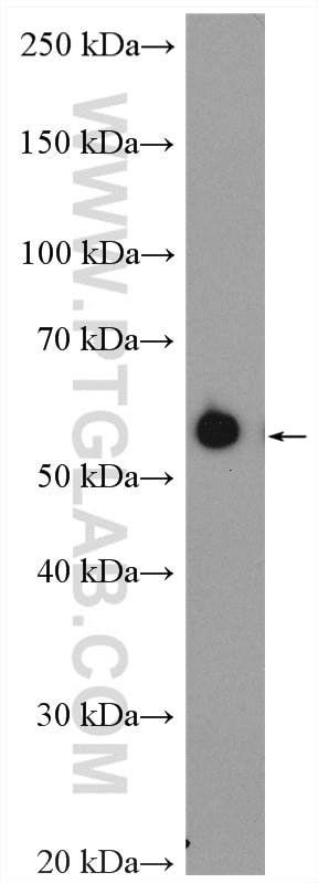 Western Blot (WB) analysis of rat skin tissue using Cytokeratin 6B Polyclonal antibody (17391-1-AP)