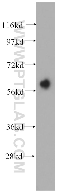 Western Blot (WB) analysis of mouse skin tissue using Cytokeratin 6B Polyclonal antibody (17391-1-AP)