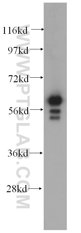 Western Blot (WB) analysis of A431 cells using Cytokeratin 6B Polyclonal antibody (17391-1-AP)