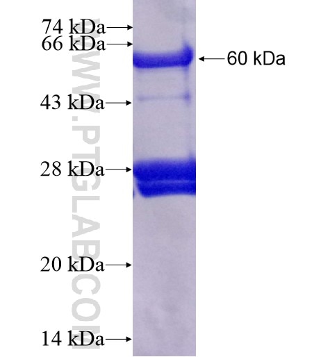 KRT6B fusion protein Ag11288 SDS-PAGE