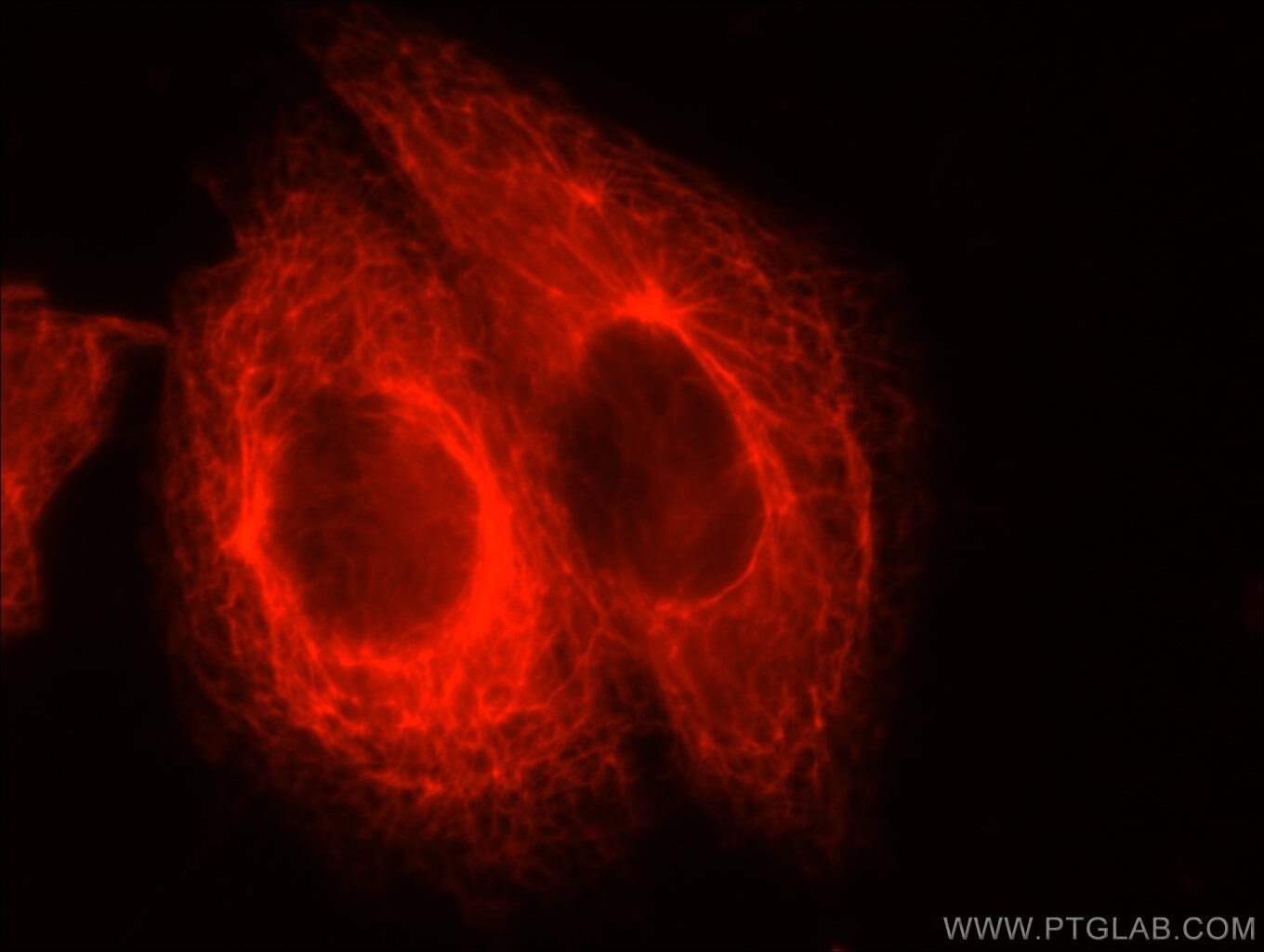 Cytokeratin 7