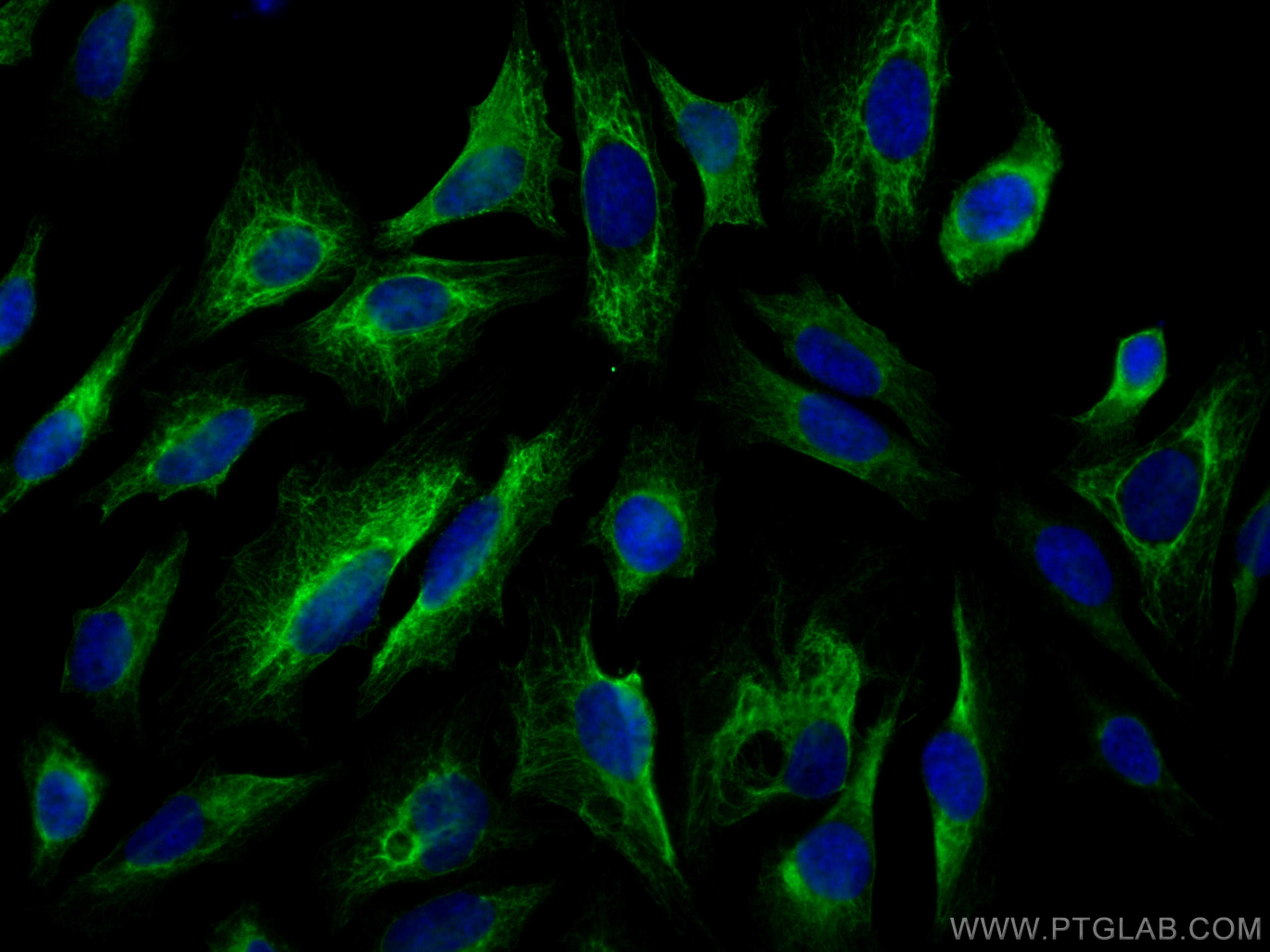 Immunofluorescence (IF) / fluorescent staining of HeLa cells using Cytokeratin 7 Polyclonal antibody (15539-1-AP)