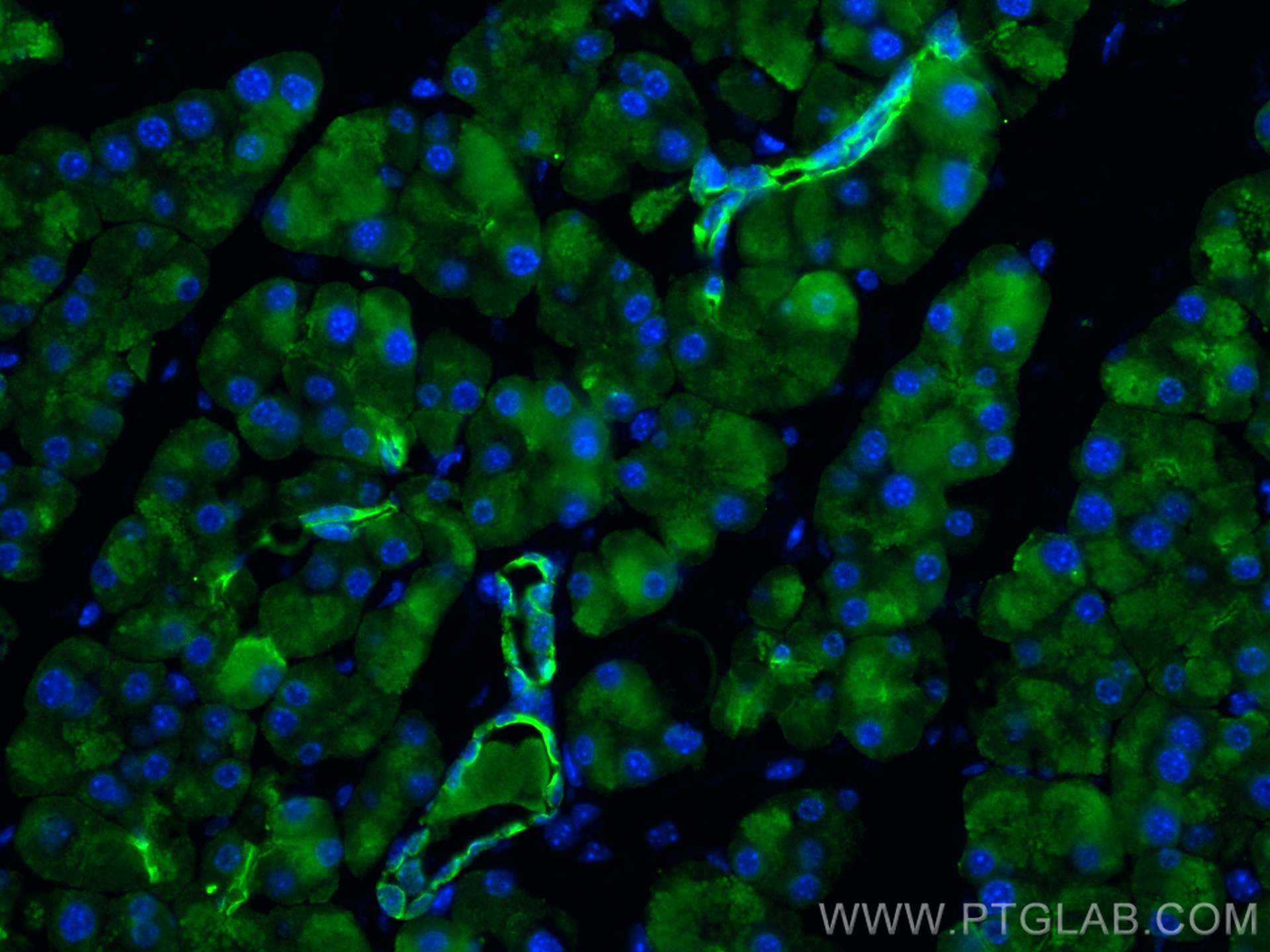 Immunofluorescence (IF) / fluorescent staining of mouse pancreas tissue using Cytokeratin 7 Polyclonal antibody (15539-1-AP)