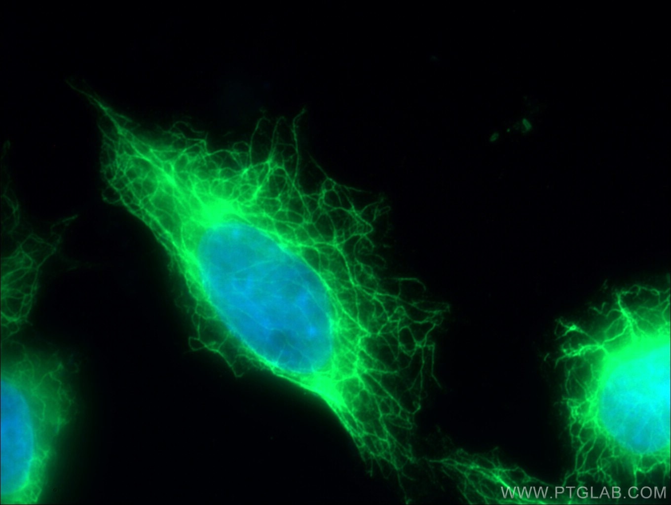 IF Staining of HeLa using 15539-1-AP