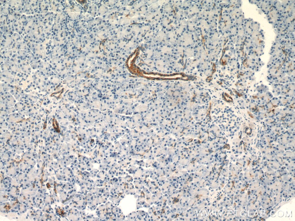 Immunohistochemistry (IHC) staining of human pancreas tissue using Cytokeratin 7 Polyclonal antibody (15539-1-AP)