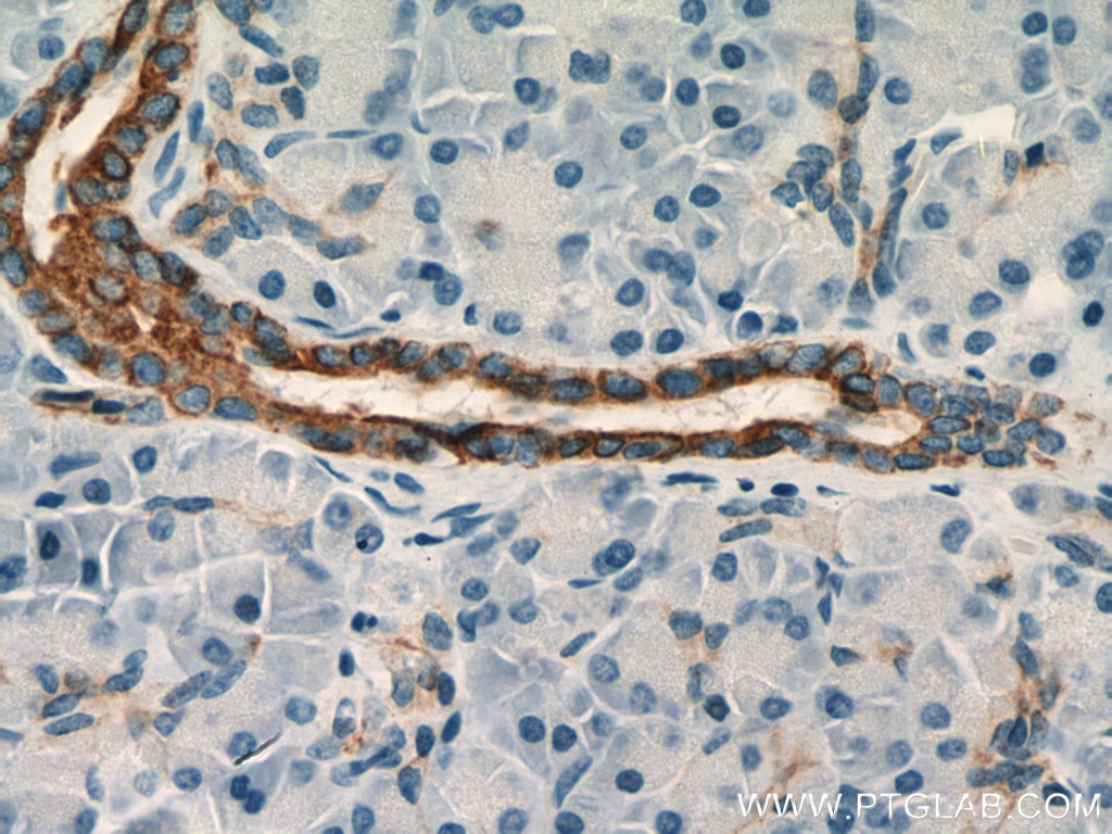 Immunohistochemistry (IHC) staining of human pancreas tissue using Cytokeratin 7 Polyclonal antibody (15539-1-AP)