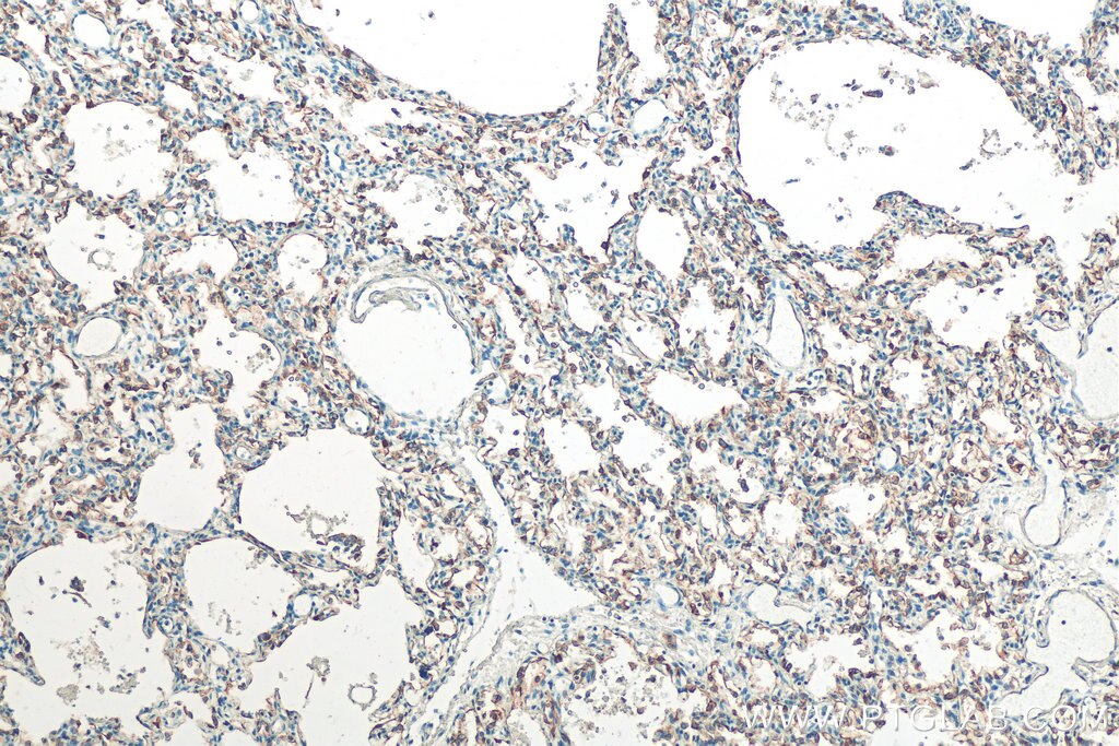 Immunohistochemistry (IHC) staining of human lung tissue using Cytokeratin 7 Polyclonal antibody (15539-1-AP)