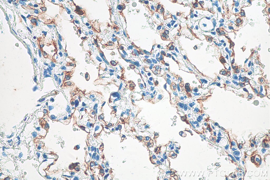 IHC staining of human lung using 15539-1-AP