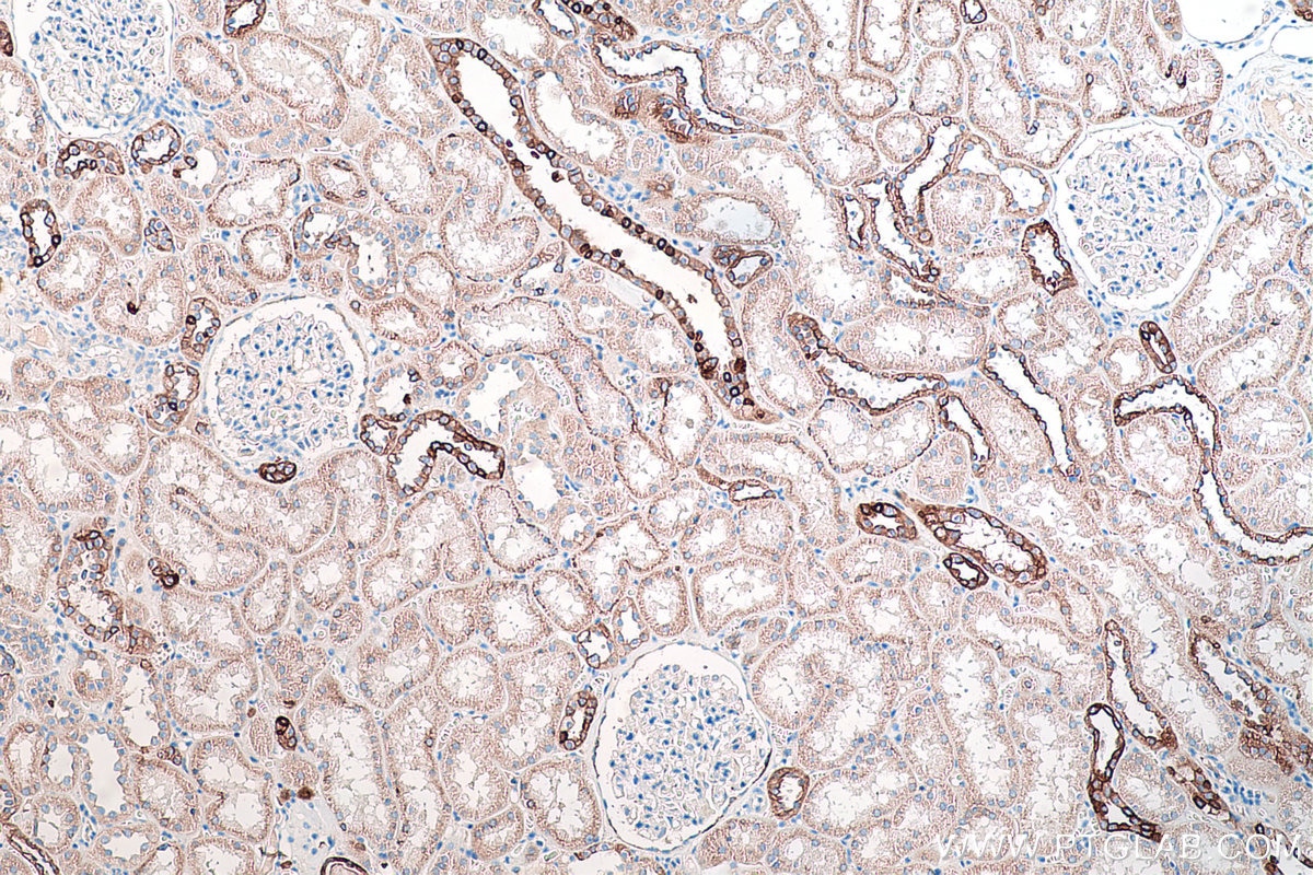 Immunohistochemistry (IHC) staining of human kidney tissue using Cytokeratin 7 Polyclonal antibody (15539-1-AP)