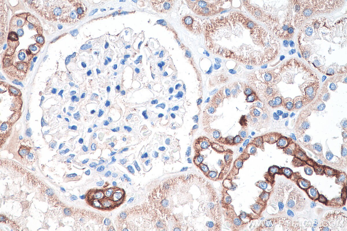 Immunohistochemistry (IHC) staining of human kidney tissue using Cytokeratin 7 Polyclonal antibody (15539-1-AP)