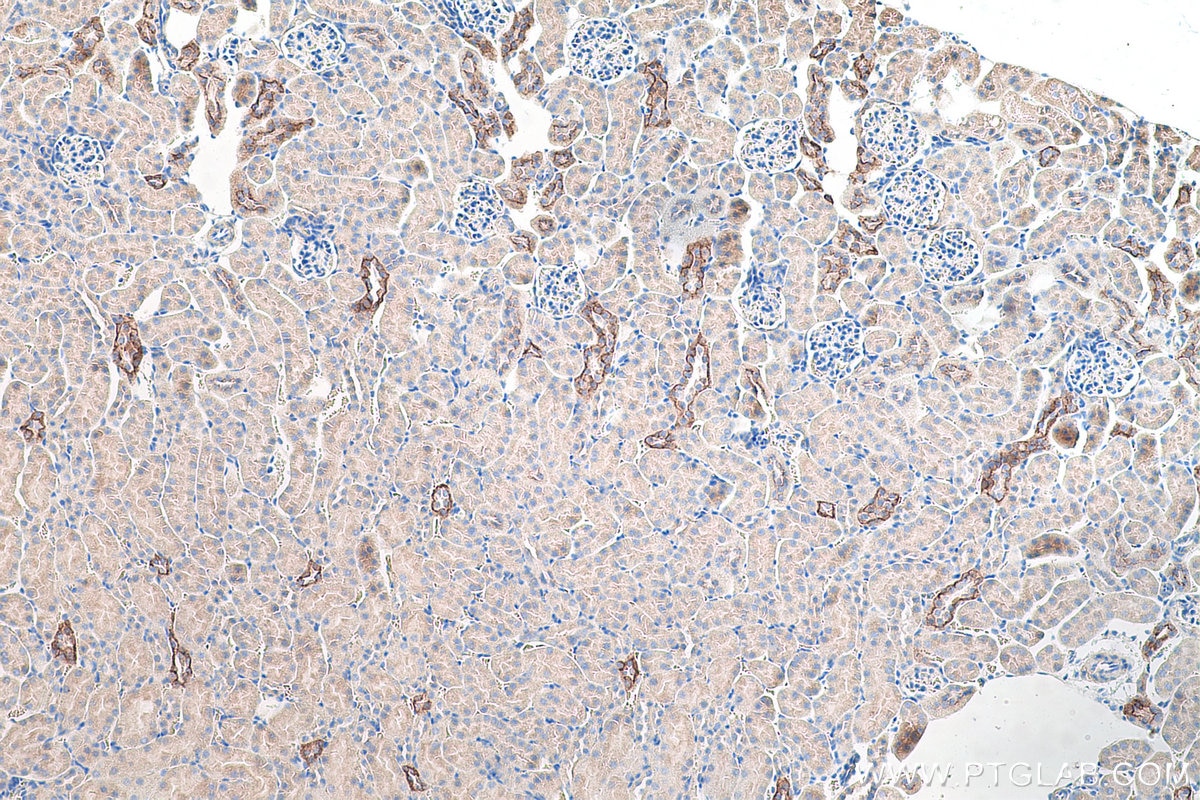 Immunohistochemistry (IHC) staining of mouse kidney tissue using Cytokeratin 7 Polyclonal antibody (15539-1-AP)