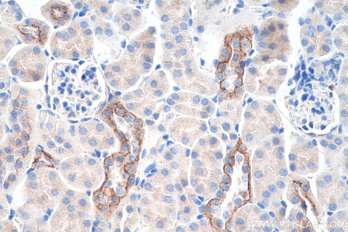 Immunohistochemistry (IHC) staining of mouse kidney tissue using Cytokeratin 7 Polyclonal antibody (15539-1-AP)