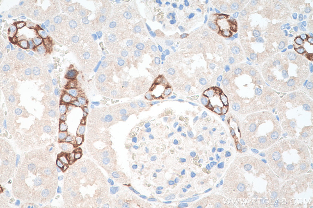 IHC staining of rat kidney using 15539-1-AP