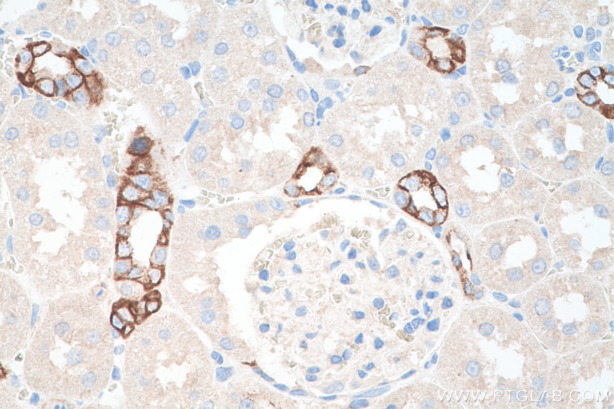 Immunohistochemistry (IHC) staining of rat kidney tissue using Cytokeratin 7 Polyclonal antibody (15539-1-AP)