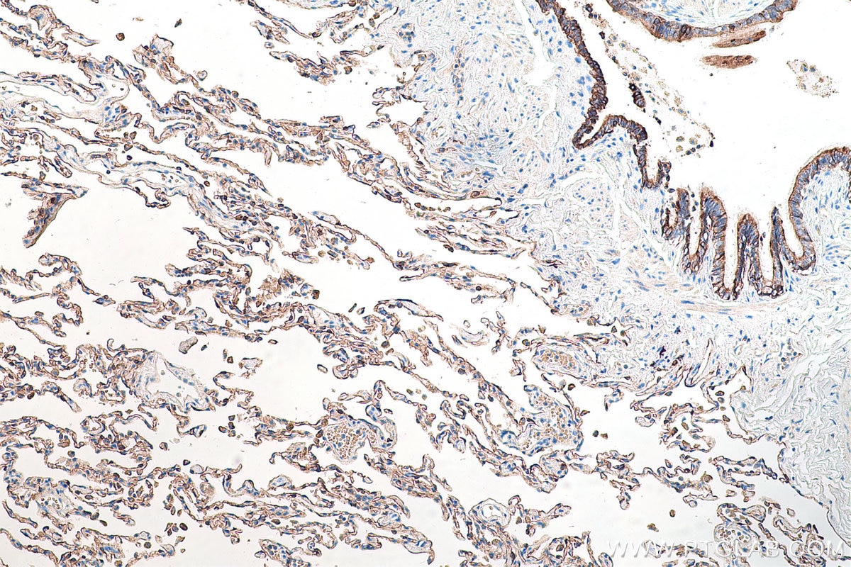 Immunohistochemistry (IHC) staining of human lung tissue using Cytokeratin 7 Polyclonal antibody (15539-1-AP)