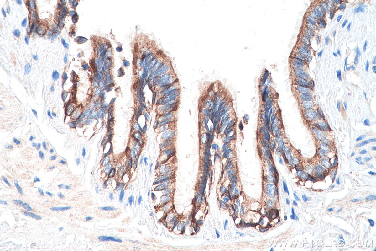 IHC staining of human lung using 15539-1-AP