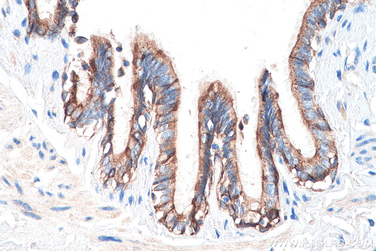 Immunohistochemistry (IHC) staining of human lung tissue using Cytokeratin 7 Polyclonal antibody (15539-1-AP)